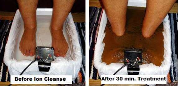 #1 great price foot bath clinic Ionic detox therapy Sydney