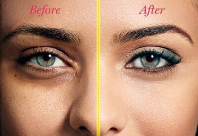 Xara_Skin_Clinic_Eye_Cream_before_and_after