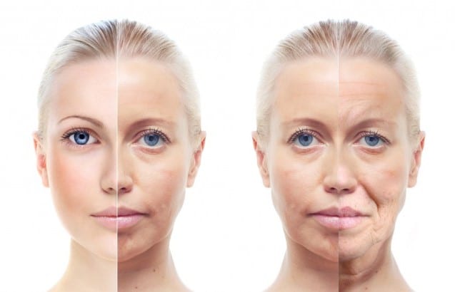 Better than botulinum dermal fillers Sydney #1 best cost