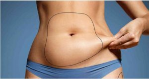 The best non-surgical fat removal cool sculpting #1 procedure