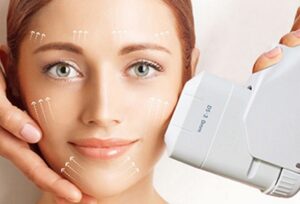 HIFU ultrasound face lift treatment Sydney #1 best treatment