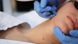 Laser clinic treatments cost price bargains North Sydney