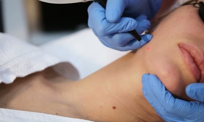 Laser clinic treatments cost price Sydney #1 best bargains