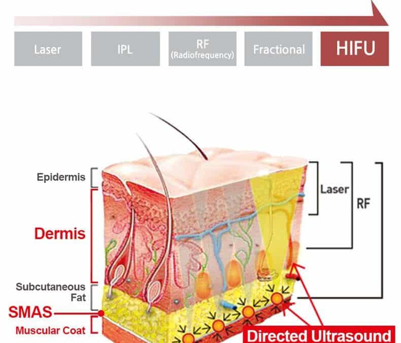 Skin tightening collagen treatments Sydney whats it about #1