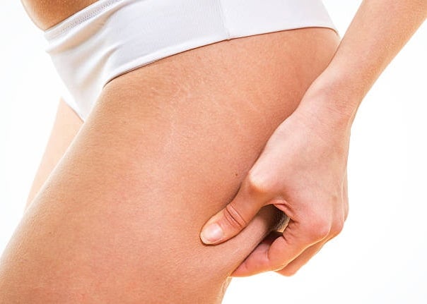 Mole milia cellulite scar fat removal Ryde body shaping loose skin tag milia