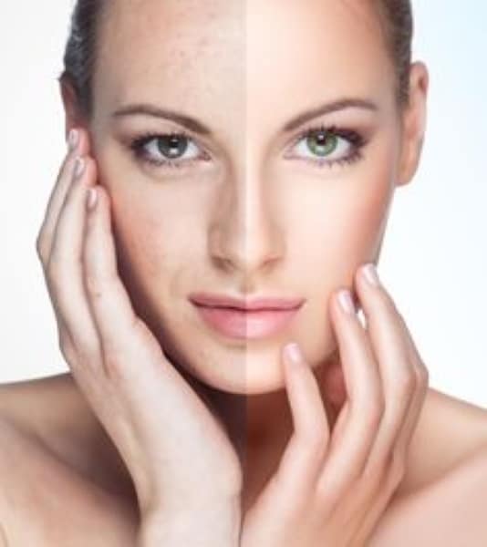 anti aging wrinkle remove face lift Neutral Bay #1 Thermagie skin tightening