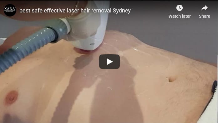 Best cheap painless safe IPL laser hair removal Sydney