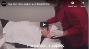 Special price laser carbon facial Sydney #1 limited offer