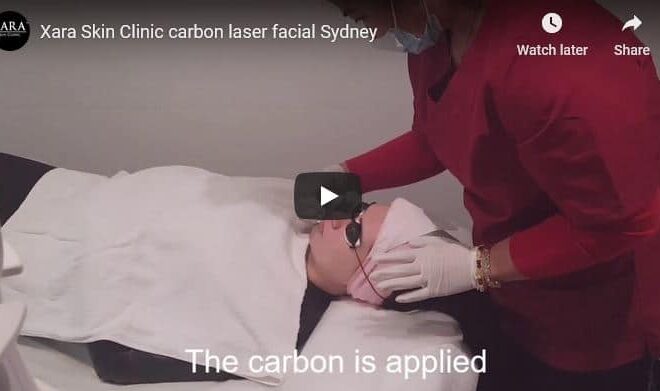 Special price laser carbon facial Sydney #1 limited offer