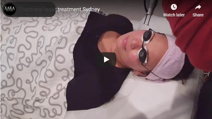 Anti aging wrinkle skin resurface Sydney 1 best rejuvenation