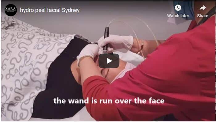 Chemical facial peel Sydney.acne scarring JPG