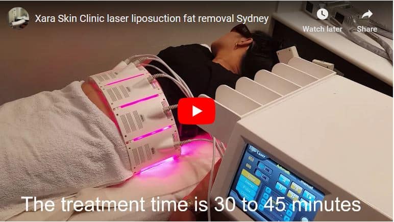 Laser fat removal reduction Sydney #1 better great price