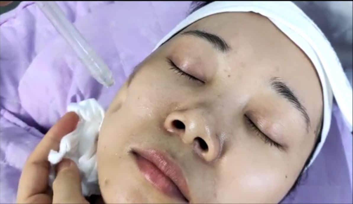 Fantastic oxygen hdro jet peel